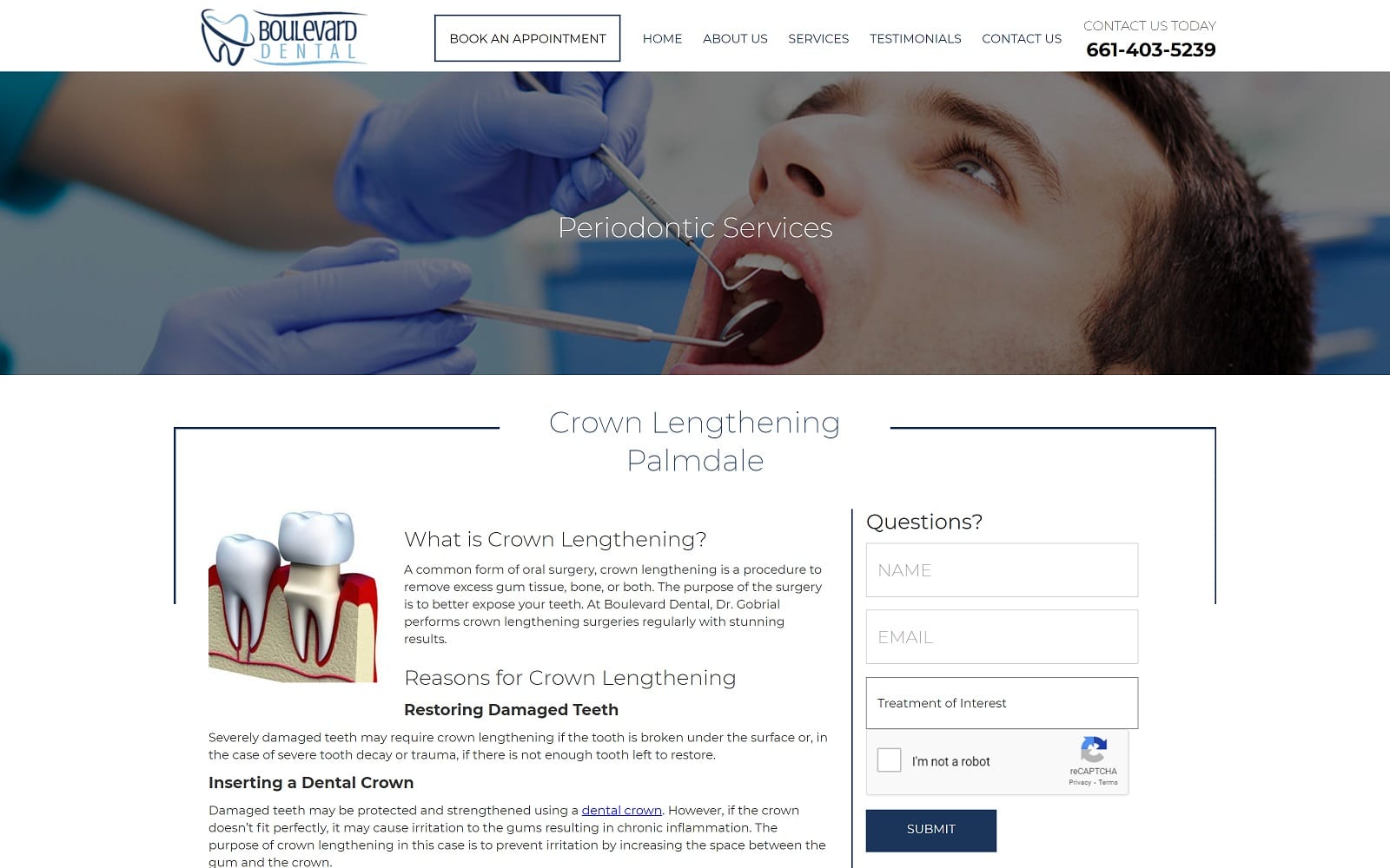 The Screenshot of Boulevard Dental dentistpalmdale.com Website