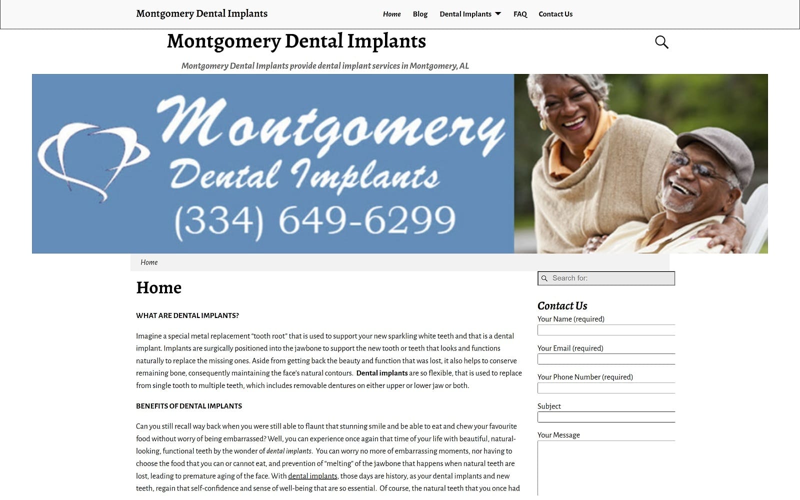 The Screenshot of Montgomery Dental Implants montgomerydentalimplants.com Website
