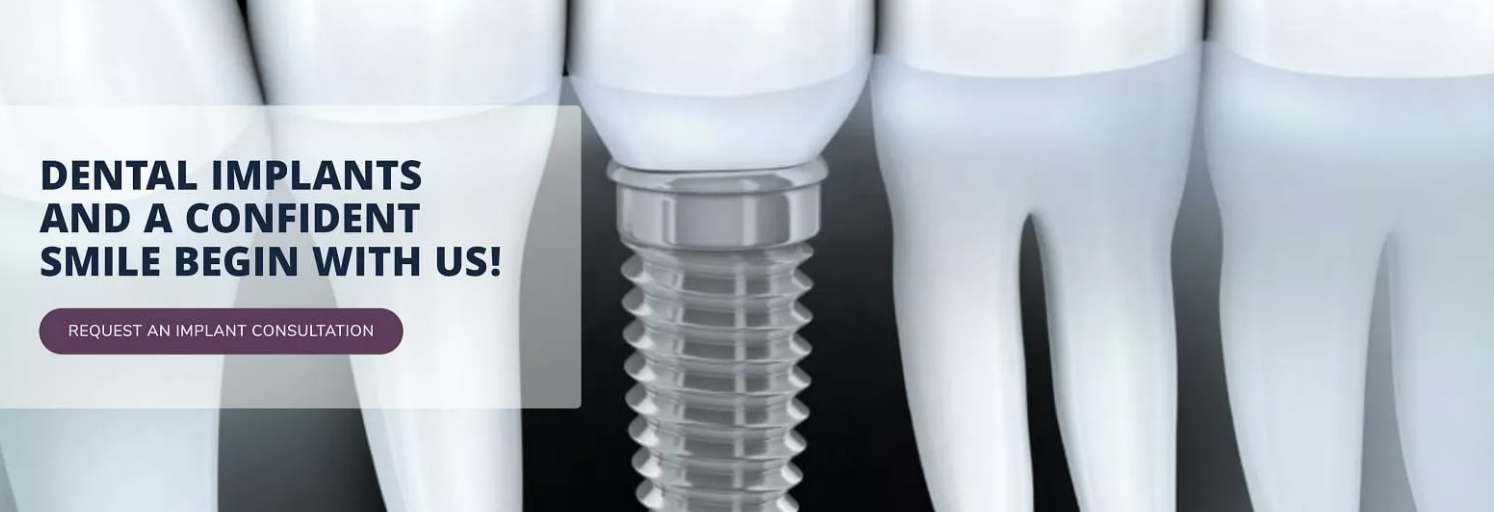 dental implant illustration